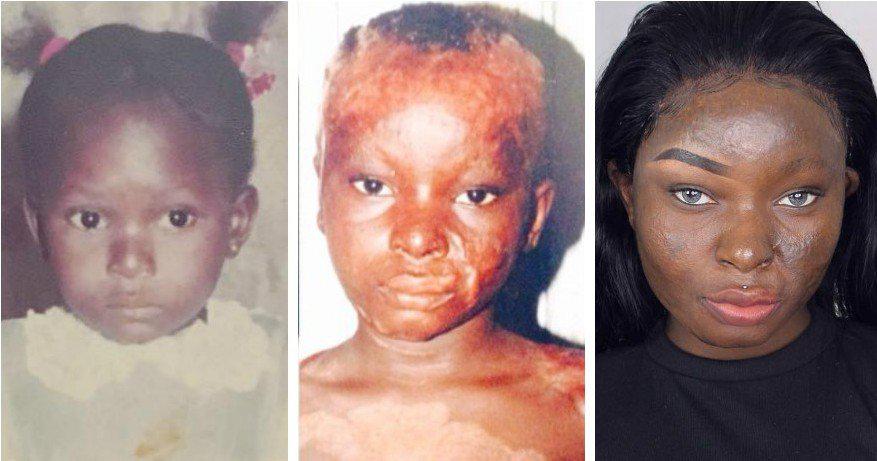 Страшная тайна девушки из Нигерии... Что скрывает 20-летняя красотка? | 1